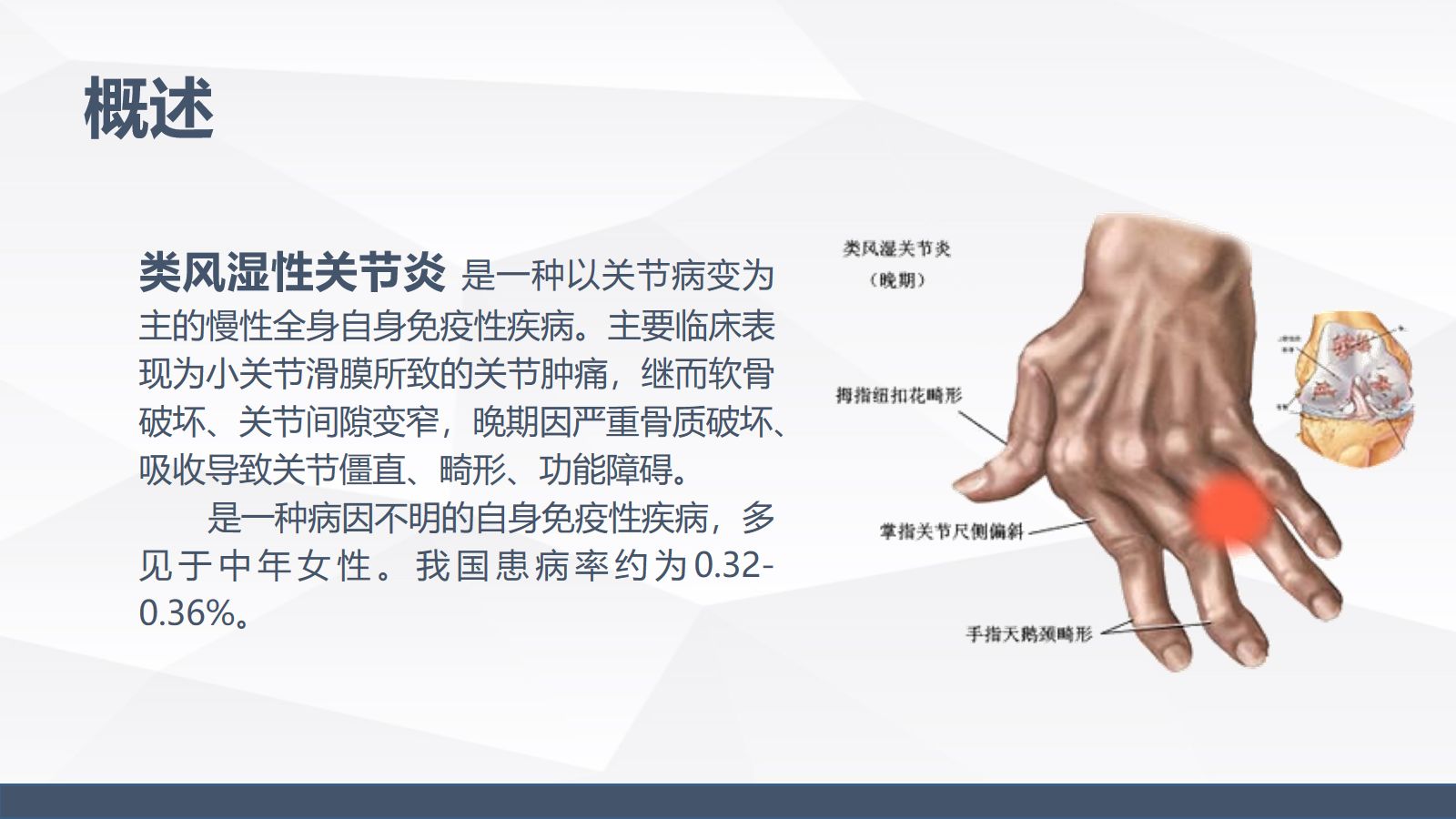 类风湿性关节炎的护理 第4页