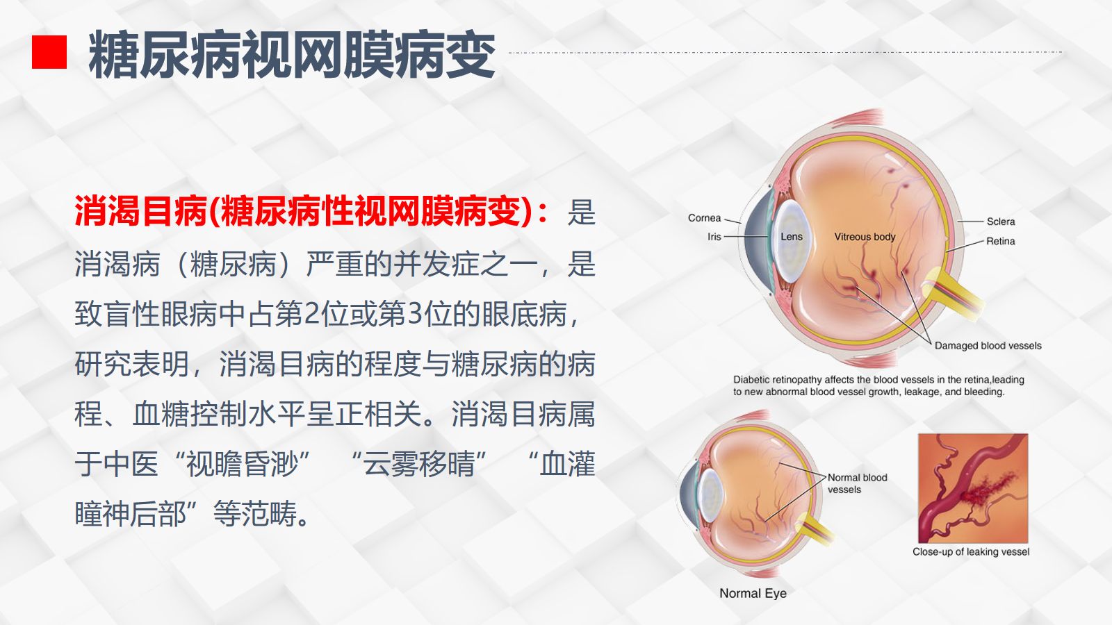 糖尿病视网膜病变患者护理查房 第4页