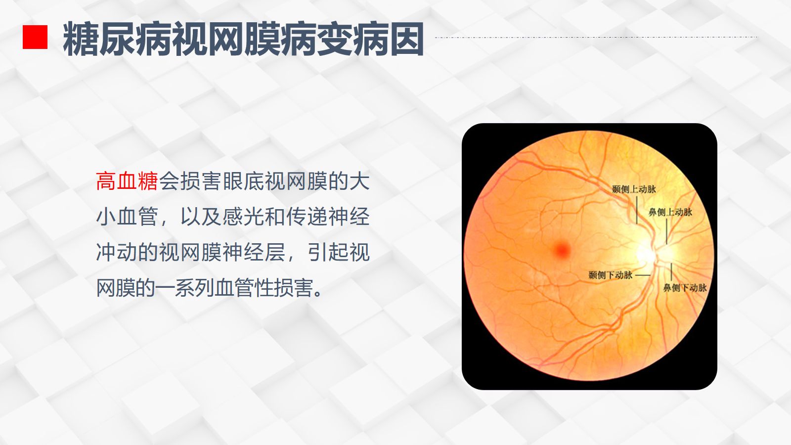 糖尿病视网膜病变患者护理查房 第5页