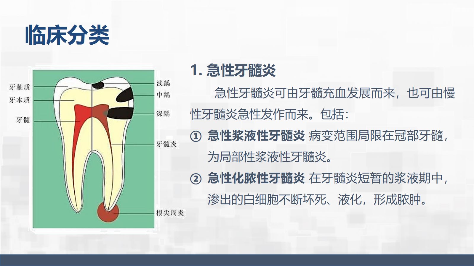 牙髓炎护理查房 第5页