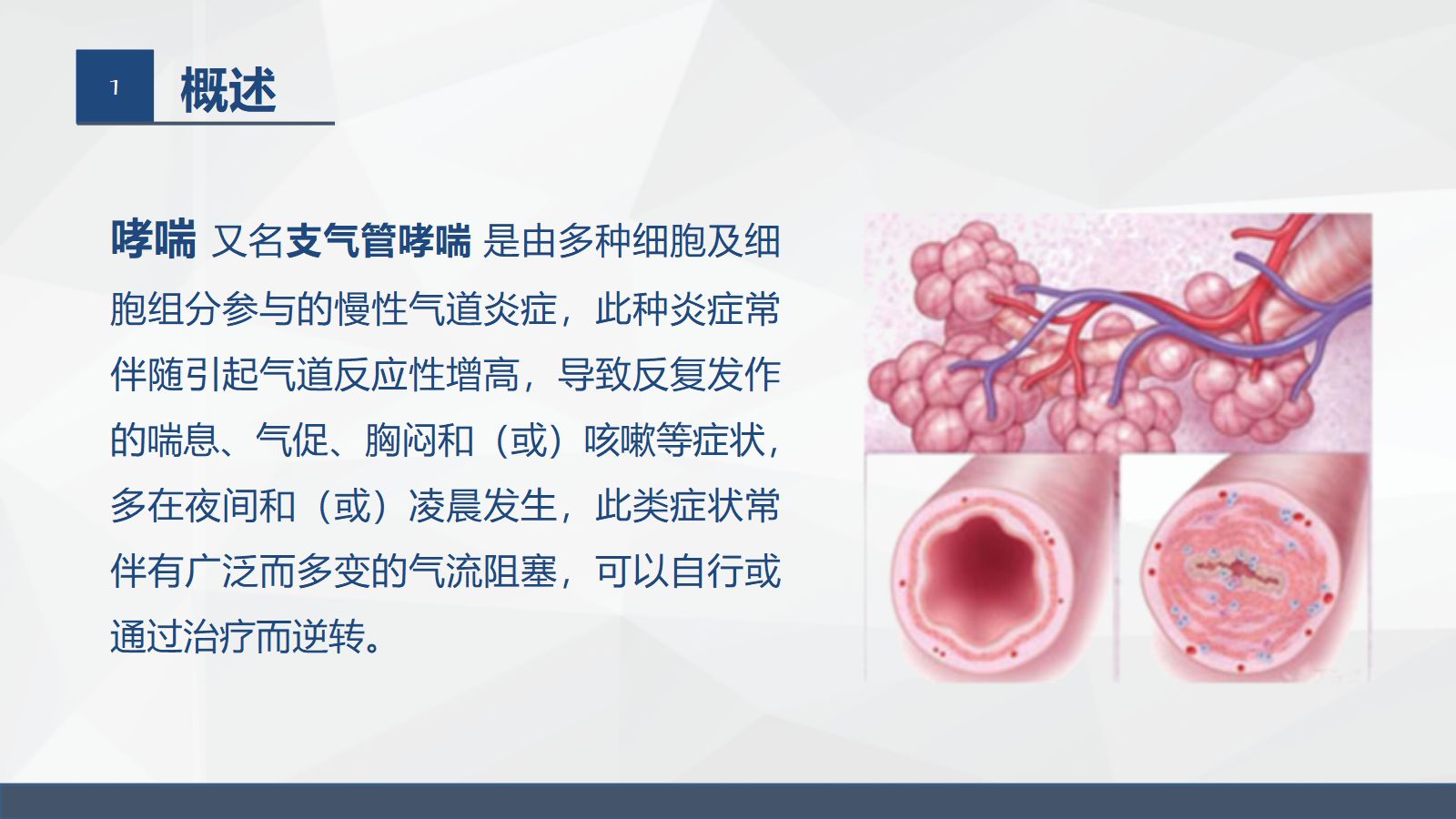 呼吸系统常见疾病的护理业务学习 第4页