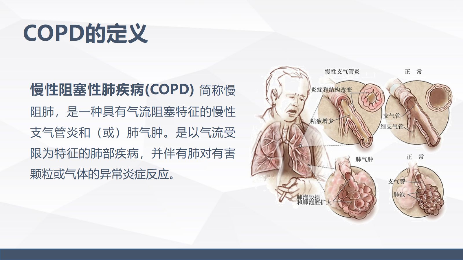 慢性阻塞性肺疾病(COPD)引起呼吸衰竭的业务学习 第4页