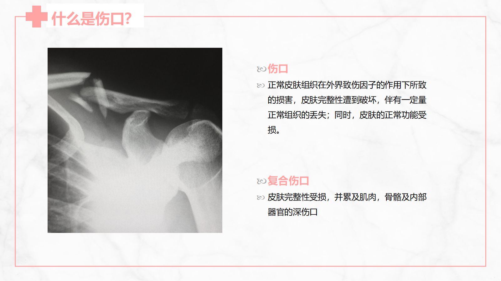 伤口护理 第4页