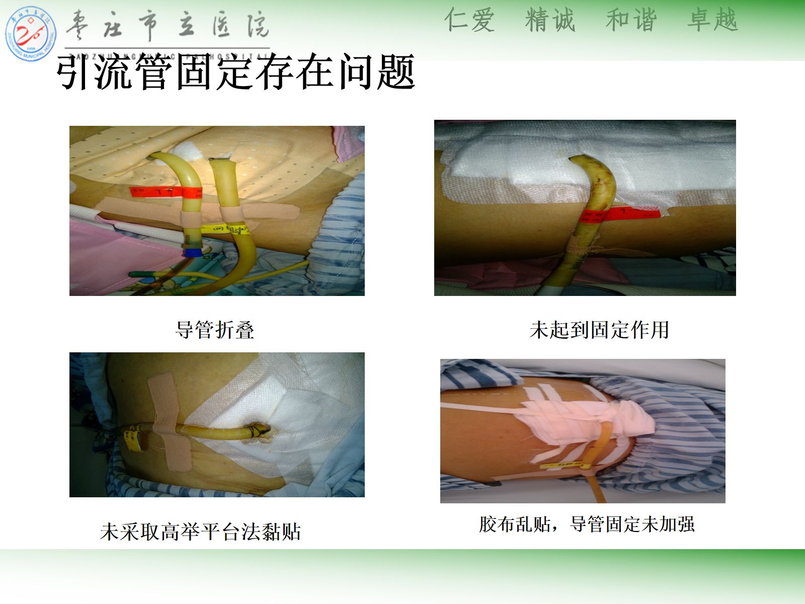 ICU常见管道固定安全管理 第5页