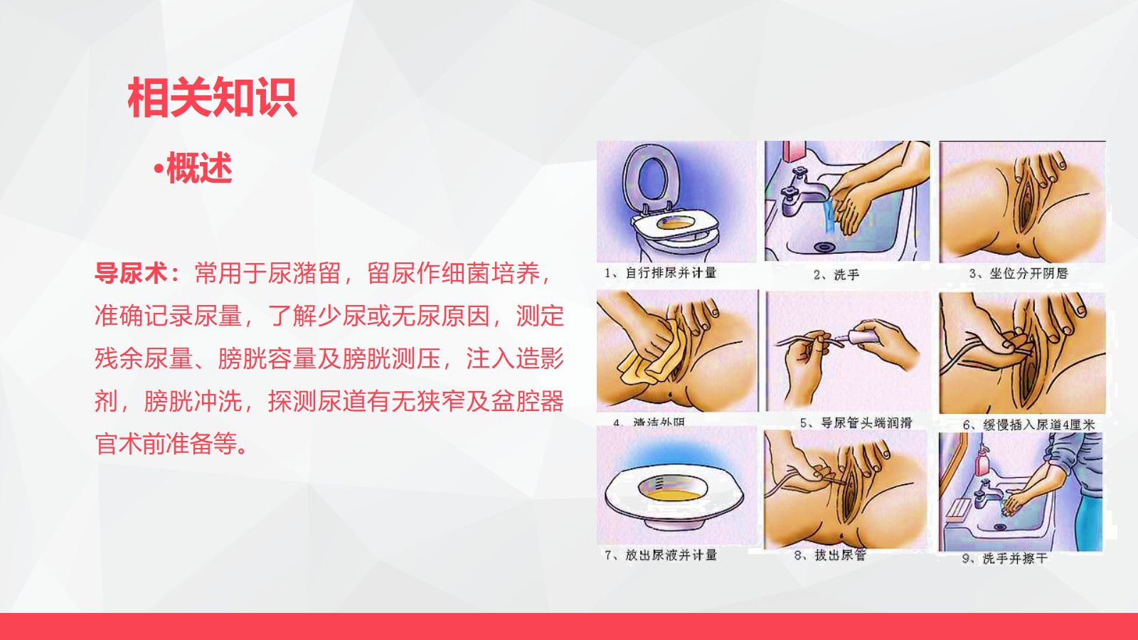 导尿术与灌肠法操作的并发症及处理 第4页