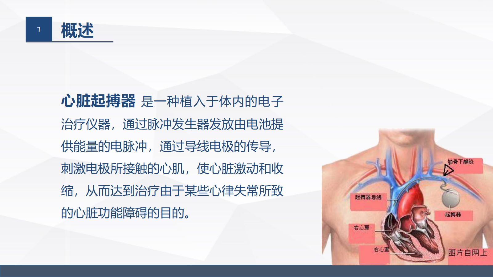 永久起搏器的业务学习 第4页