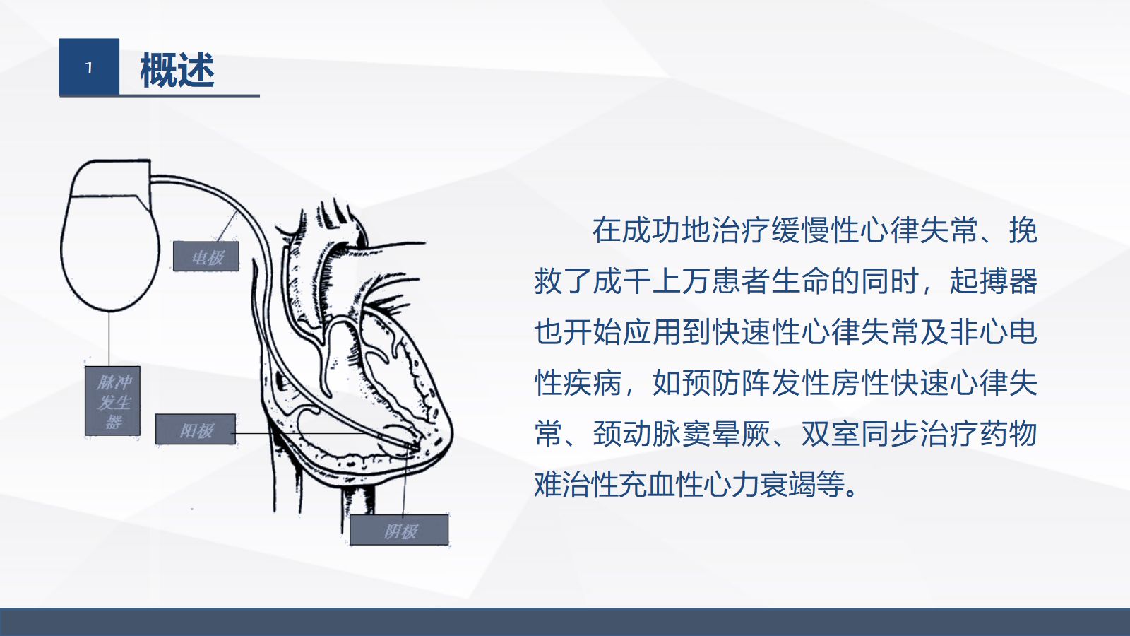 永久起搏器的业务学习 第5页