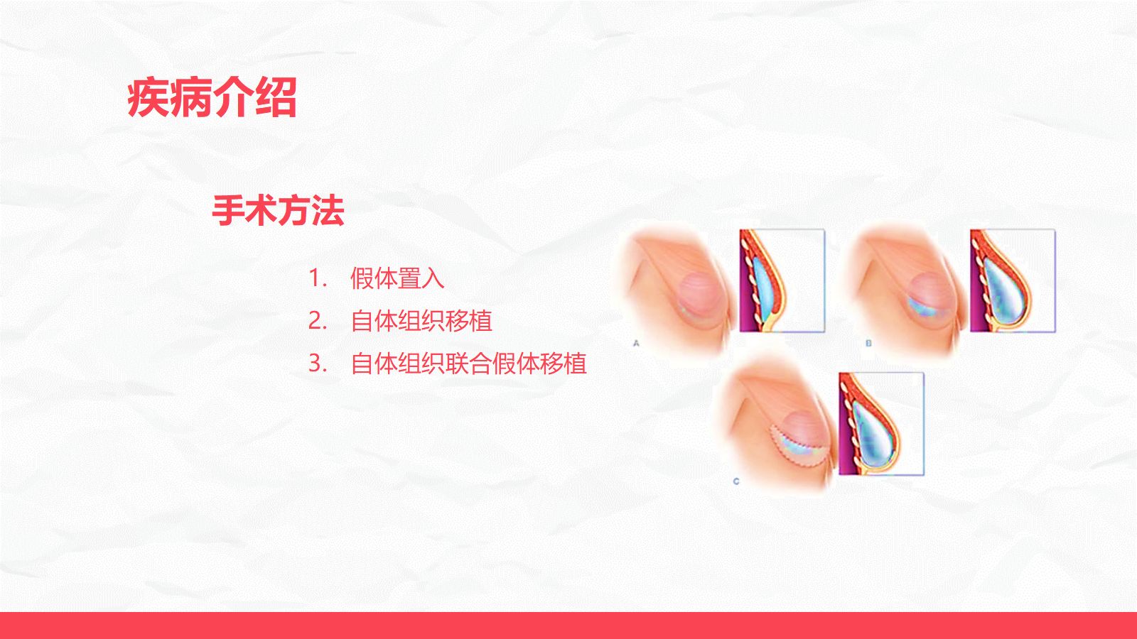 乳腺癌乳房重建术后的护理 第5页