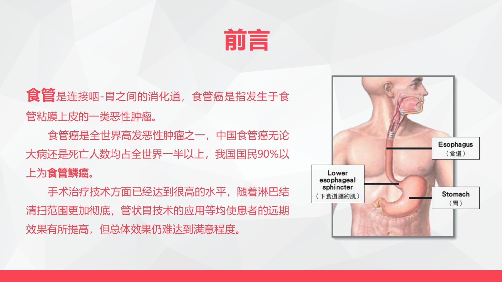 局部晚期食管癌新辅助治疗 第4页