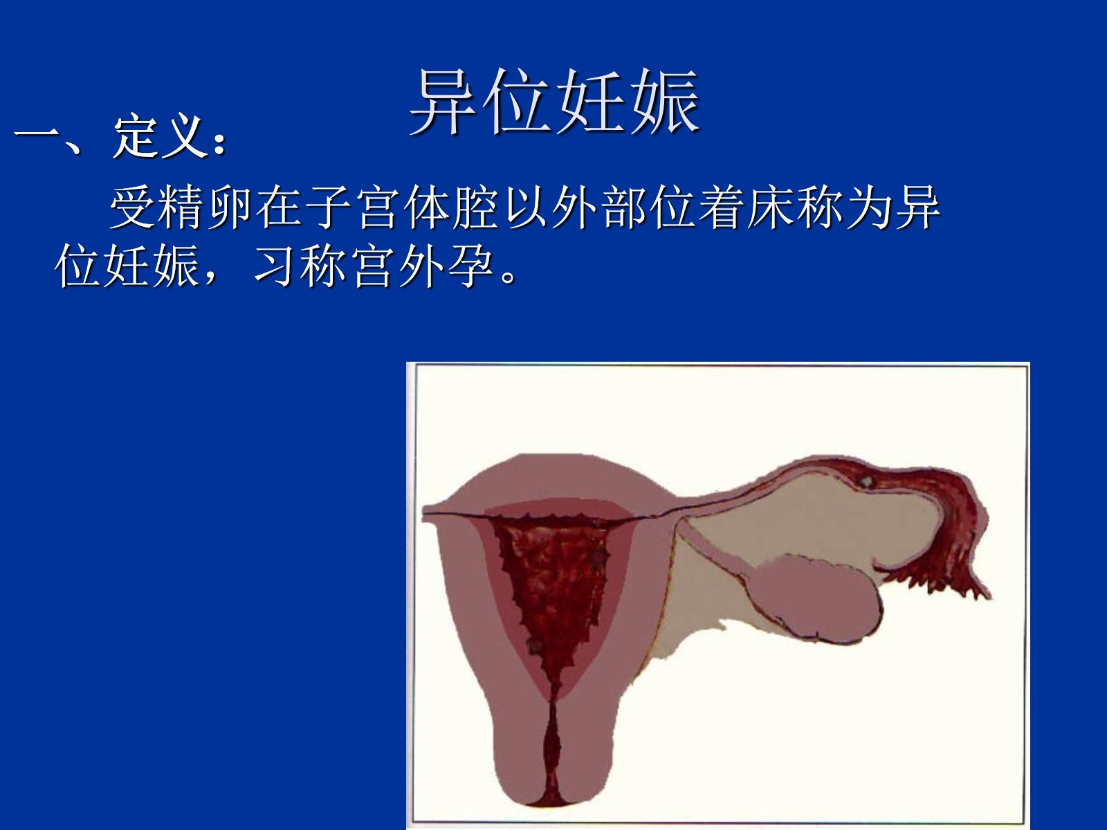 异位妊娠失血性休克的急救与护理 第3页