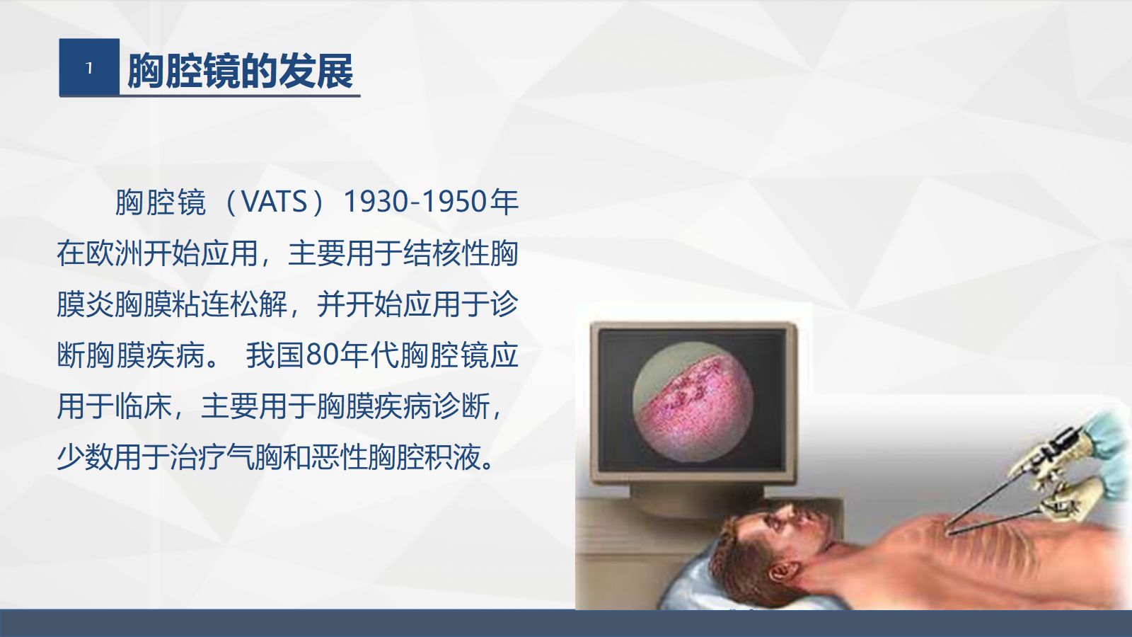 胸腔镜在胸外科的临床应用 第2页