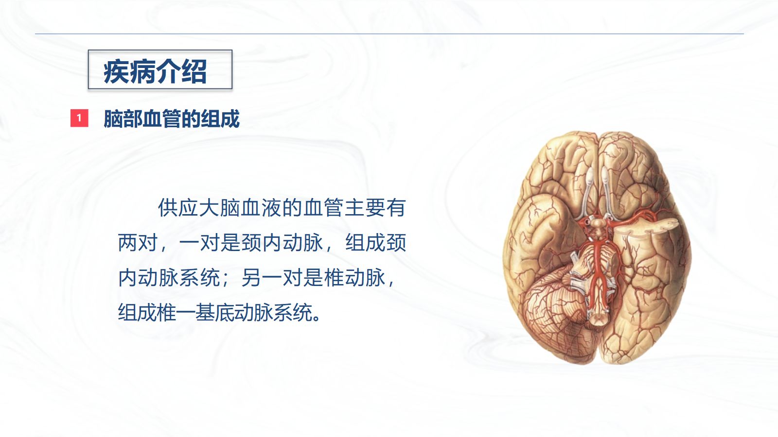 脑出血疾病介绍+术后护理 第4页