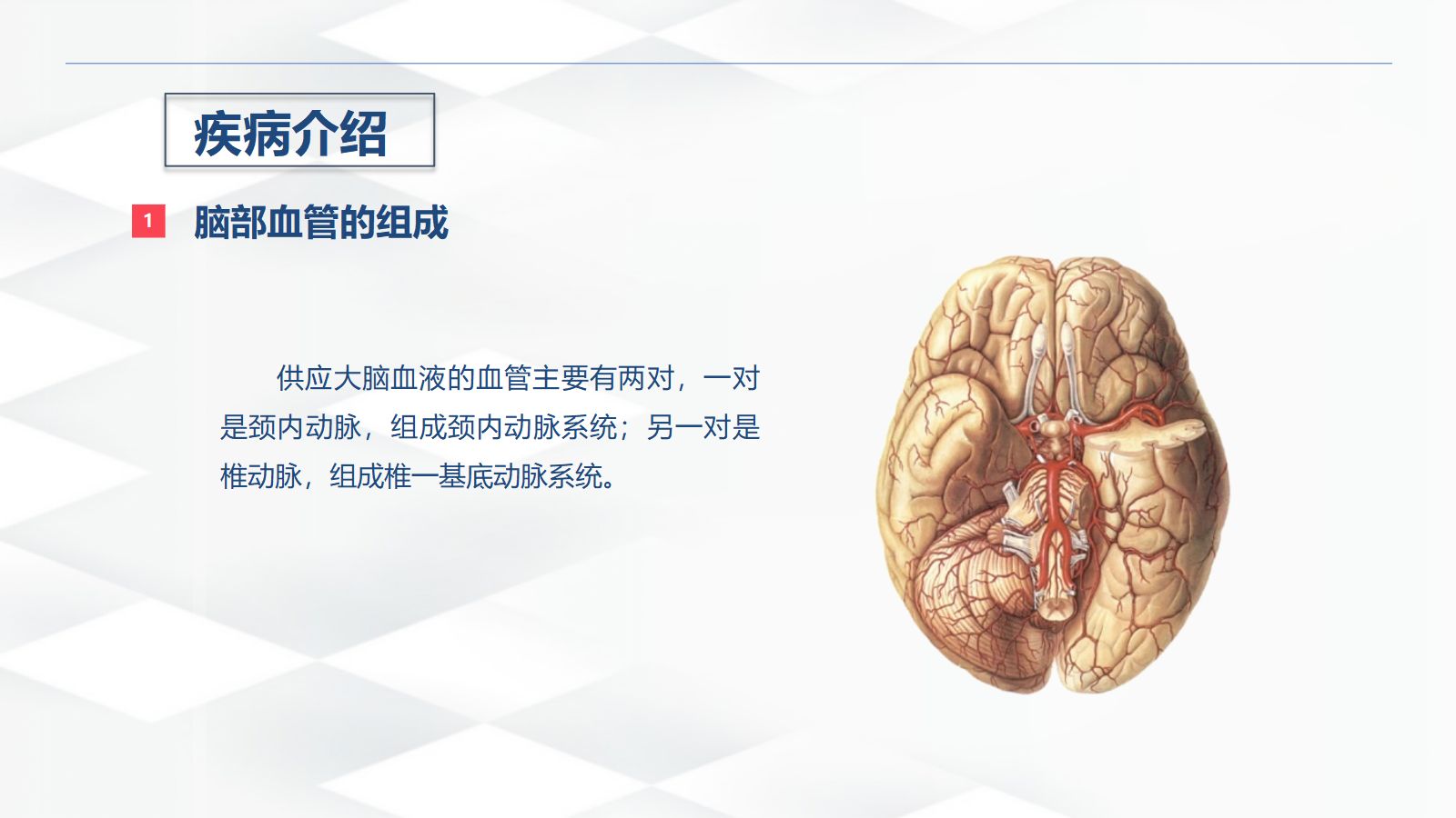 脑出血的术后护理 第4页