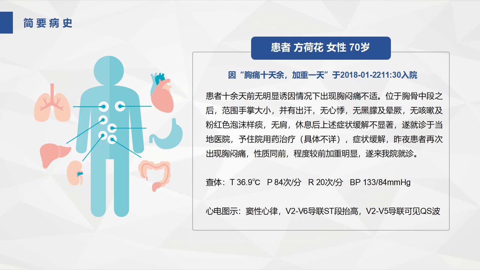 66心血管科-急性心肌梗死护理查房 第4页