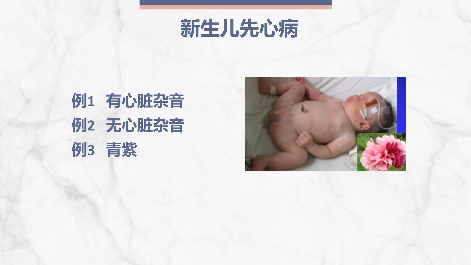 新生儿先天性心脏病病例讨论 第2页