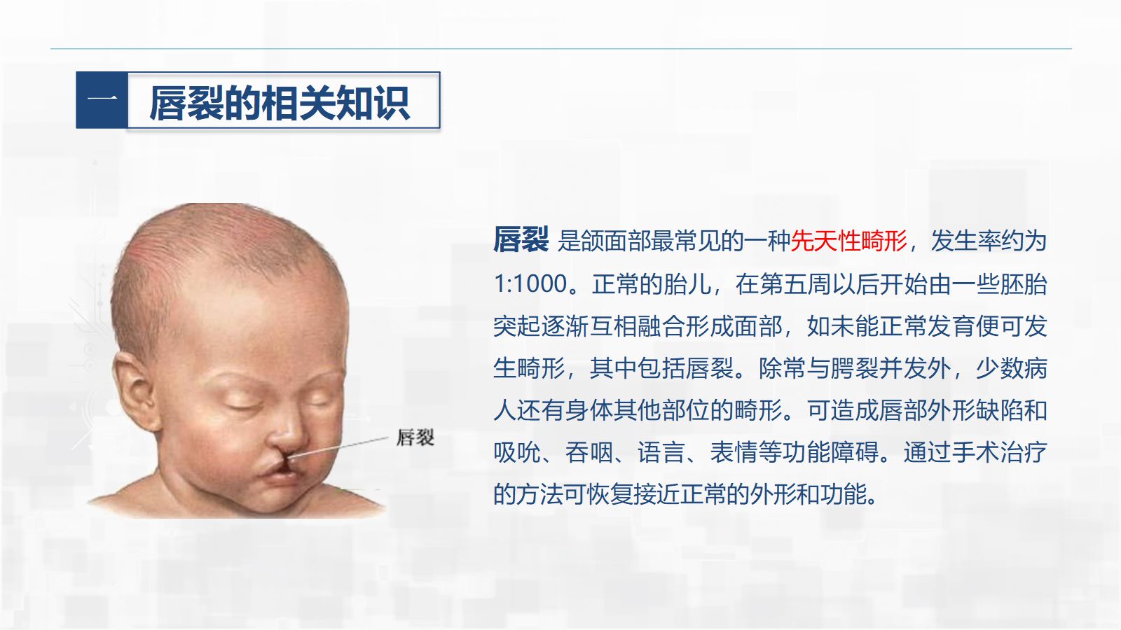 新生儿唇裂的护理+问题 第4页