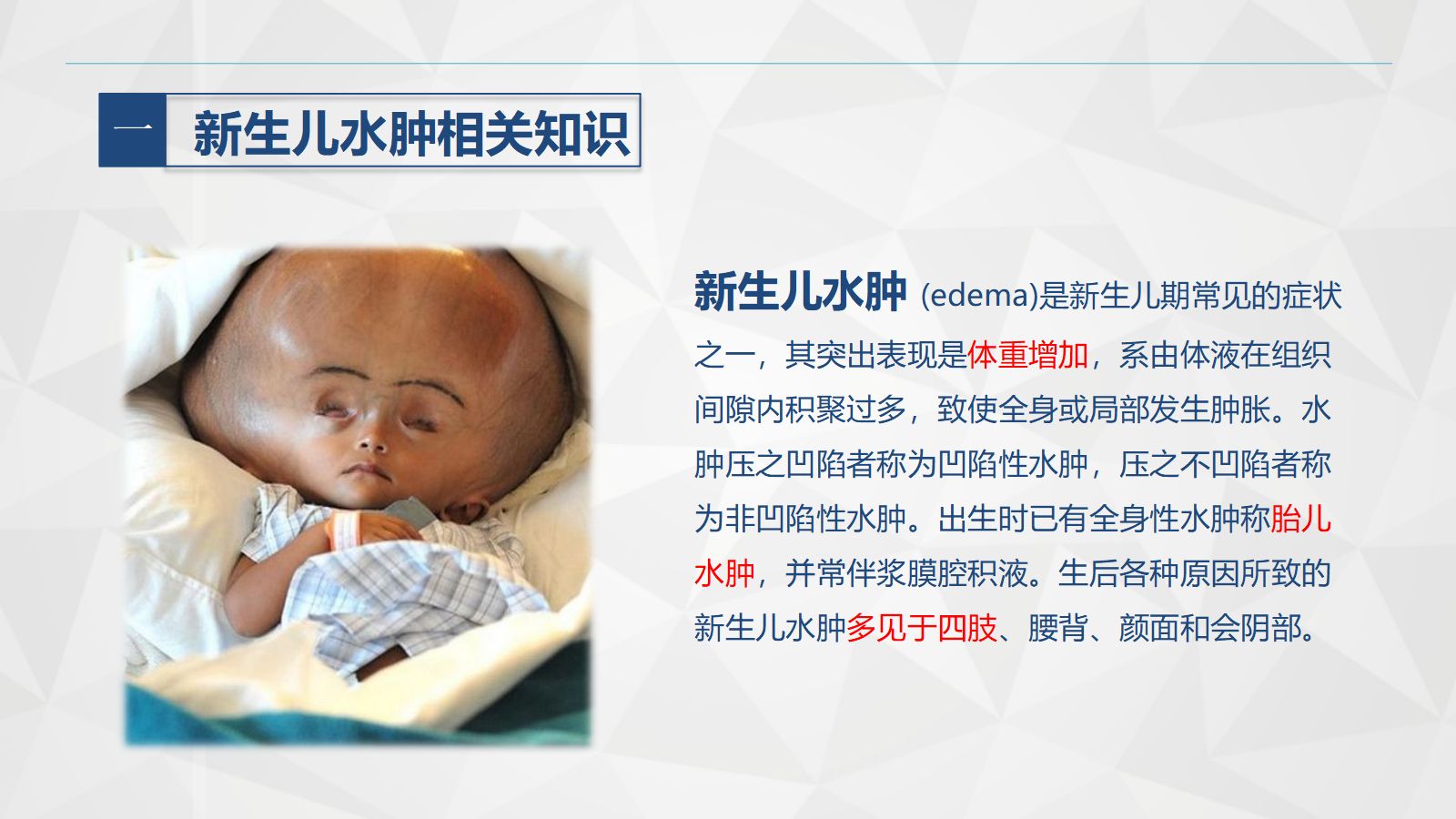 新生儿水肿的护理 第4页