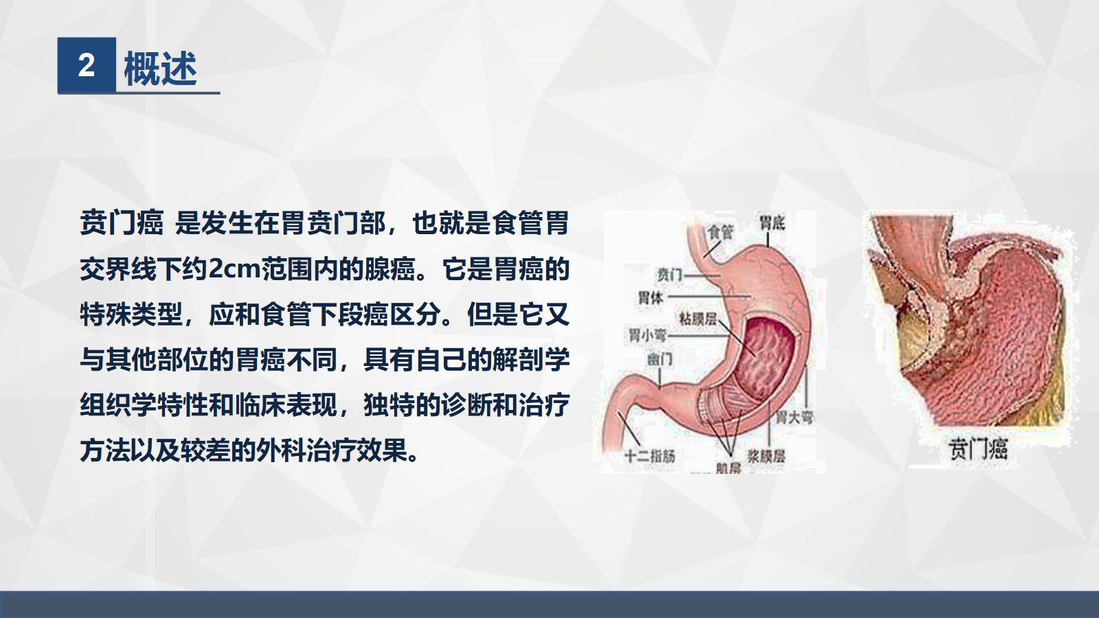43普外科-贲门癌伴脓胸吻合口瘘护理查房 第5页