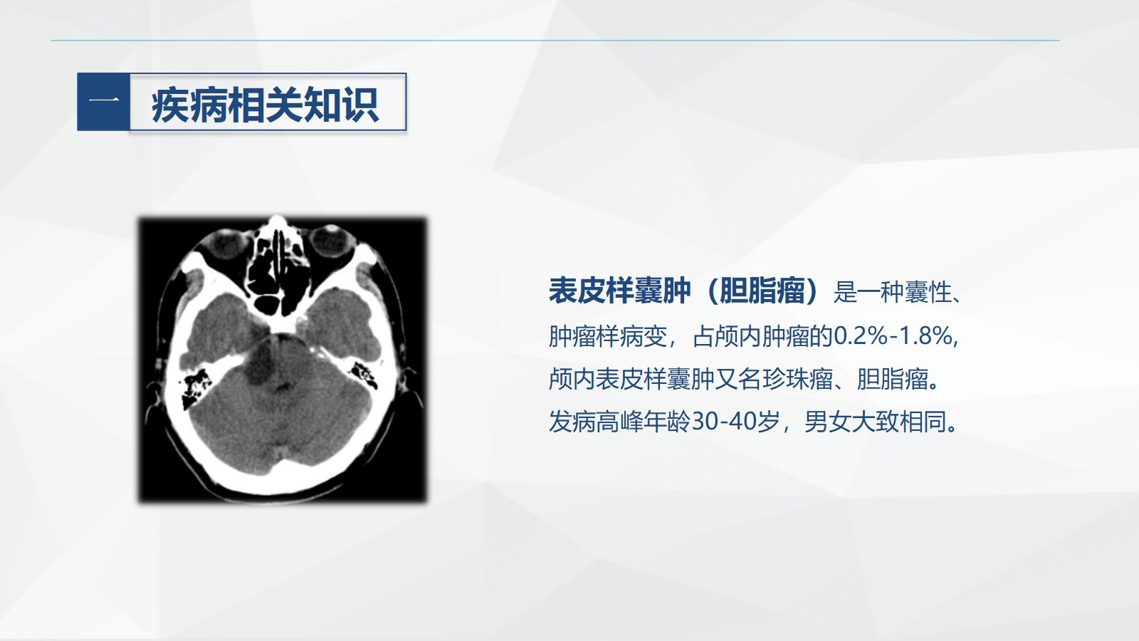 54外科-颅内表皮样囊肿患者的护理查房 第4页