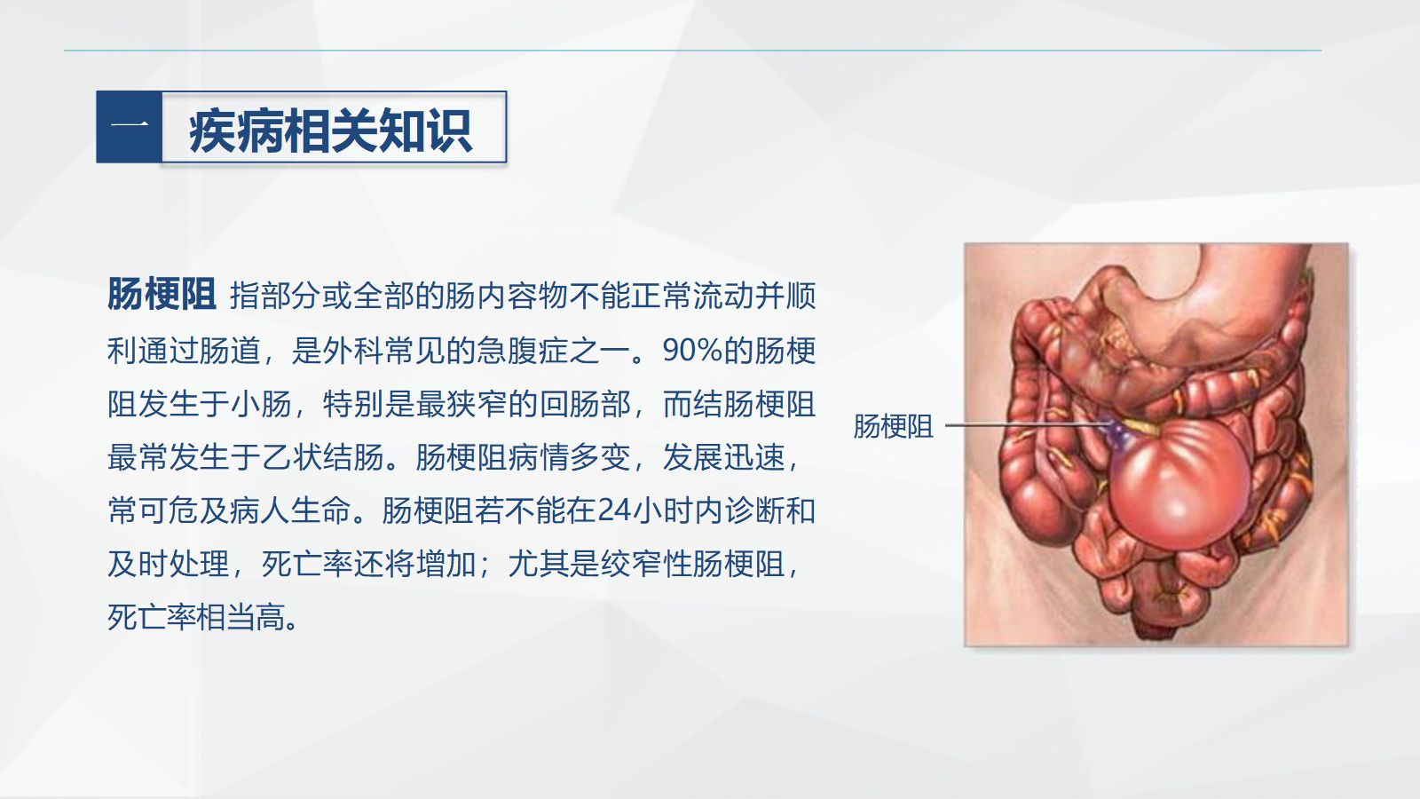 57消化内科-肠梗阻护理查房 第4页