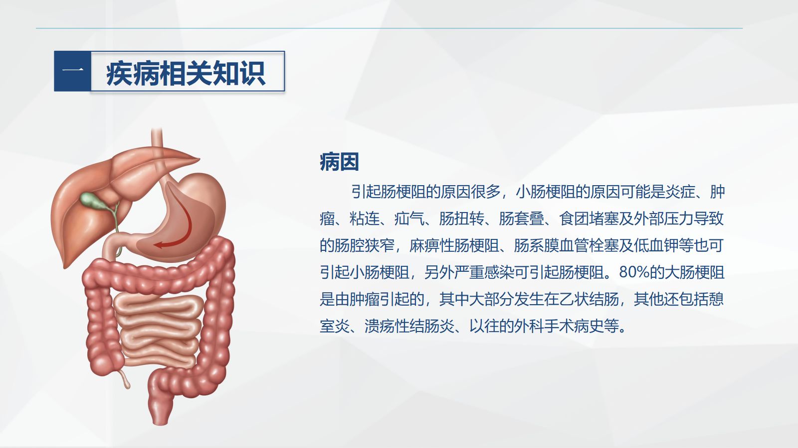 57消化内科-肠梗阻护理查房 第5页