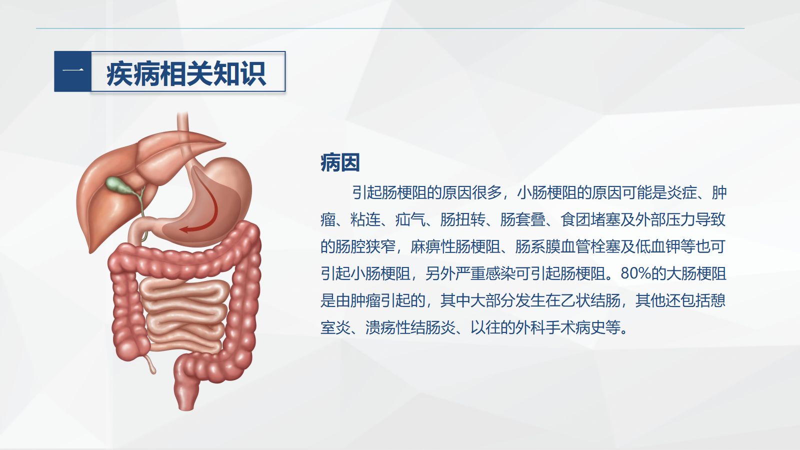 58消化内科-肠梗阻护理查房2 第5页