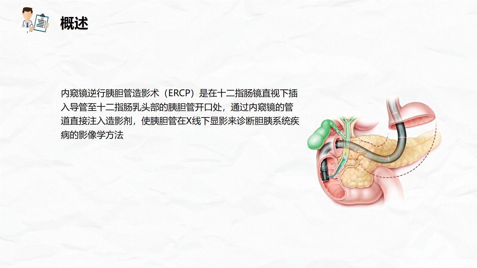 ERCP护理业务课件 第4页