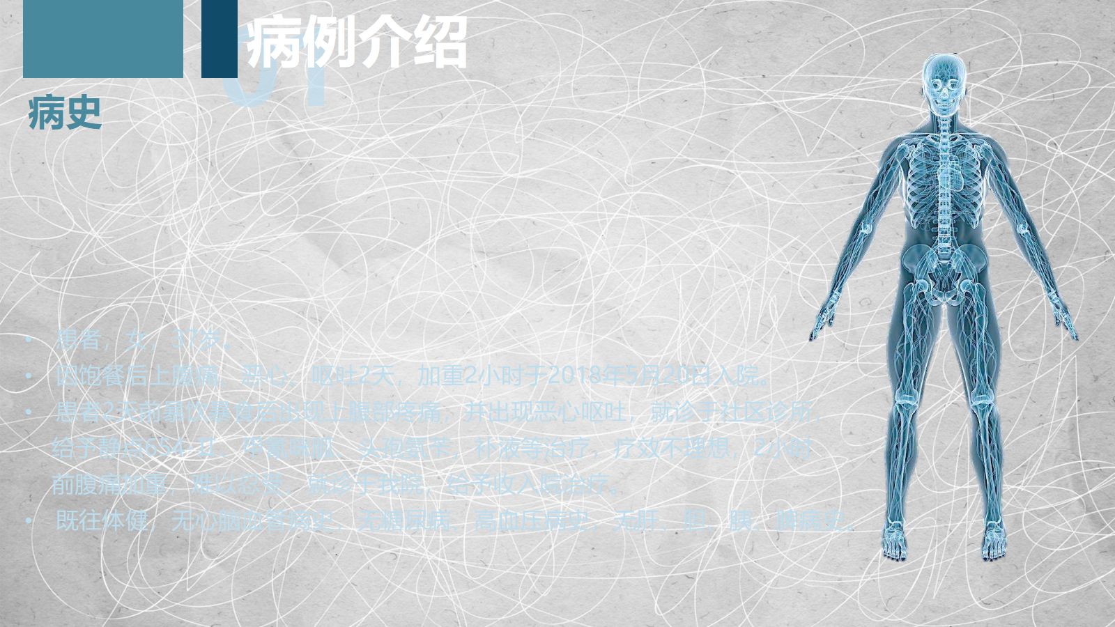 急性胰腺炎护理查房-2 第5页
