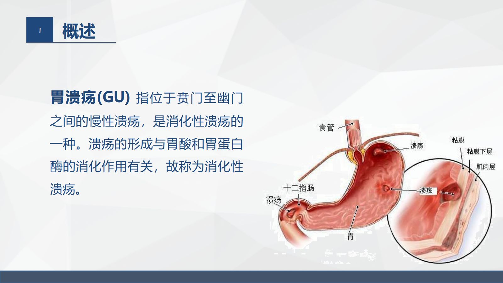胃溃疡的业务学习 第4页