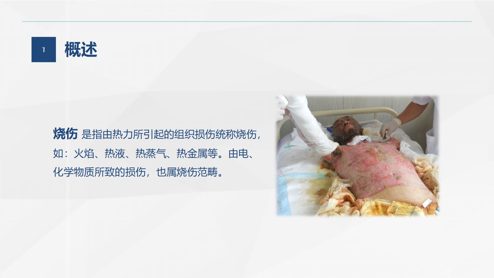 46烧伤科-烧伤患者的护理查房 第4页