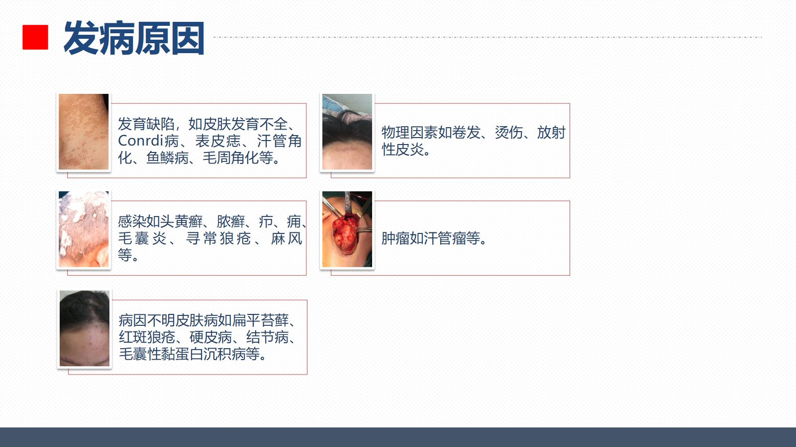 40皮肤科-瘢痕性脱发患者的护理查房 第5页