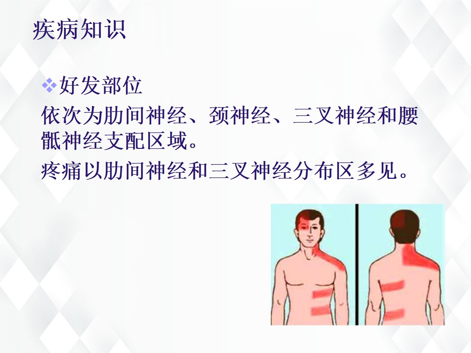 41皮肤科-带状疱疹后遗神经痛护理查房 第4页
