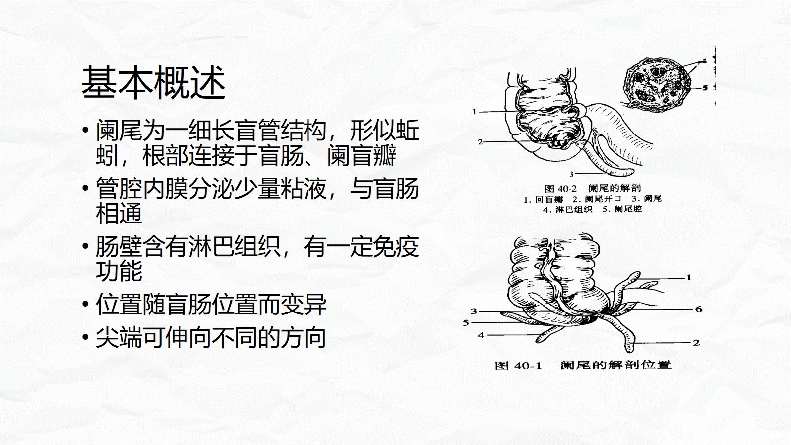 急性阑尾炎护理查房 第5页