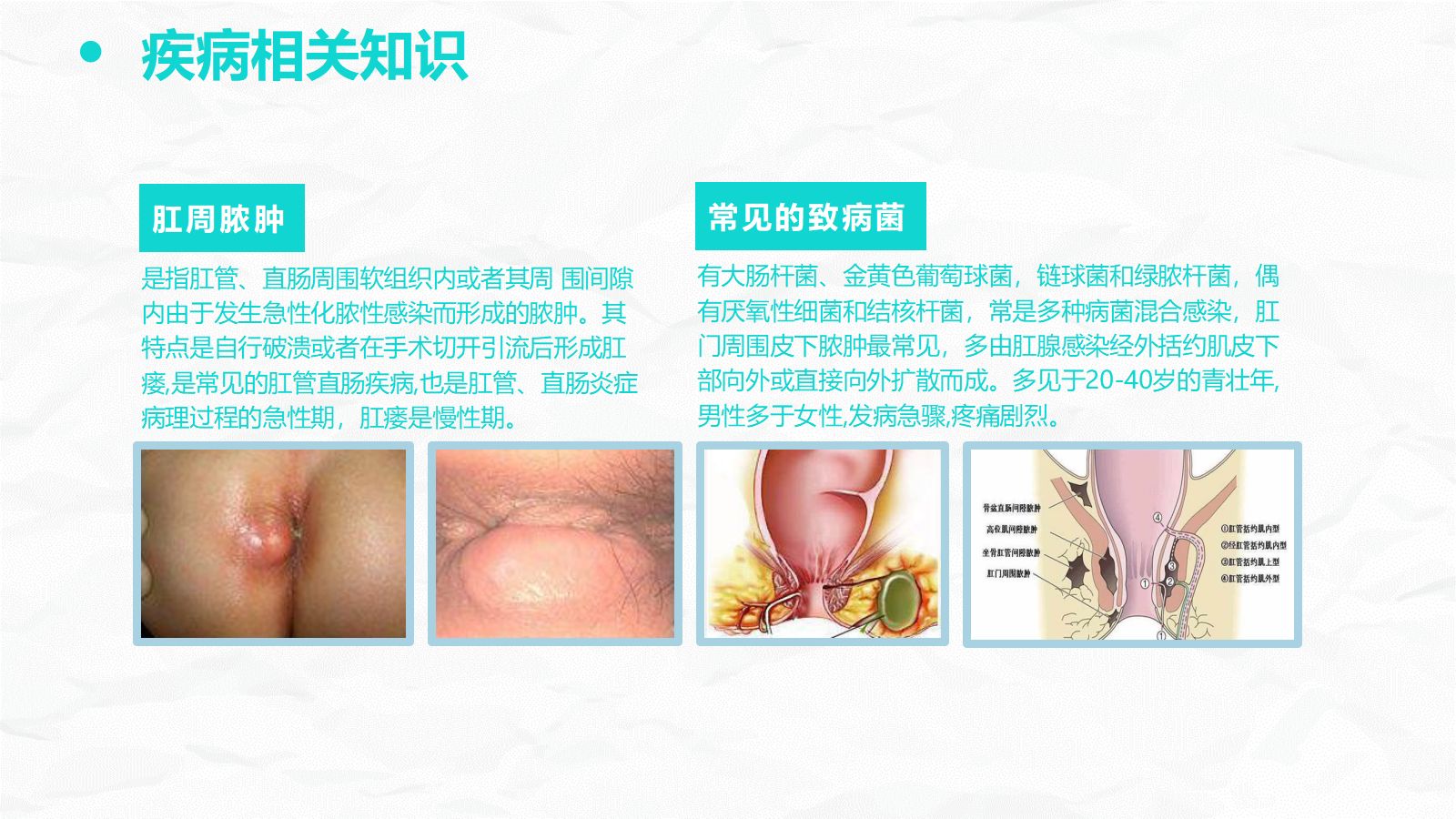 肛肠科护理查房 第4页