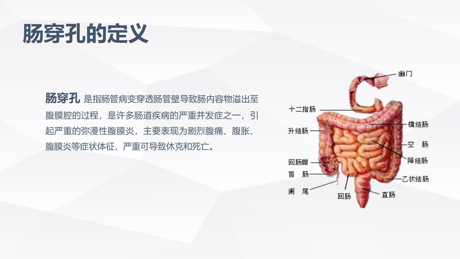 肠穿孔的护理学习 第4页