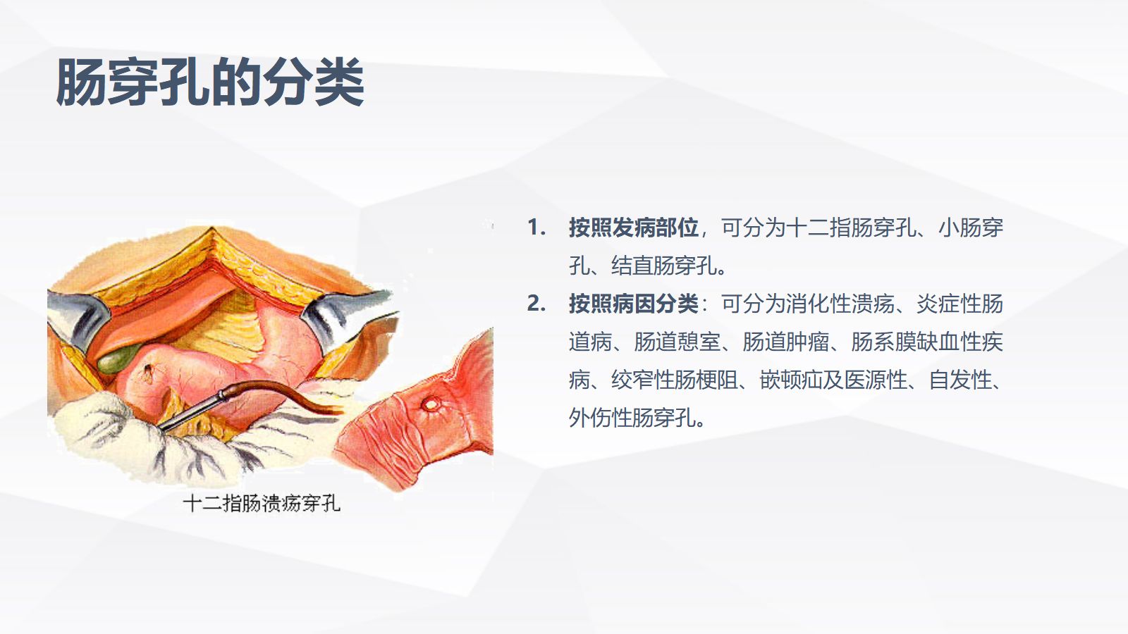 肠穿孔的护理学习 第5页