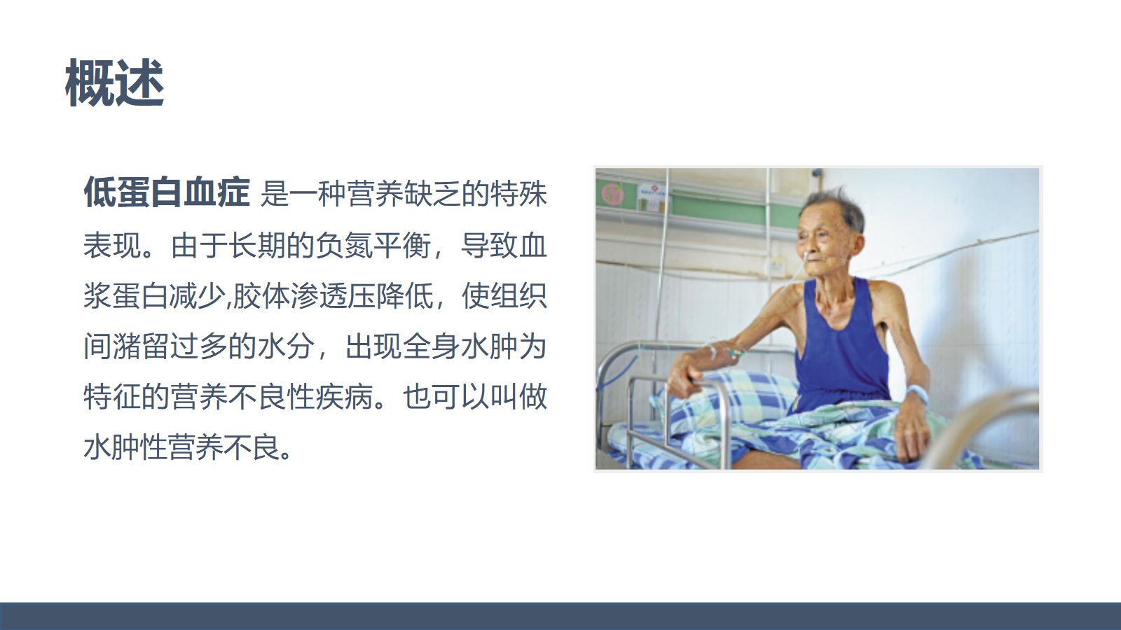 低蛋白血症的护理 第4页