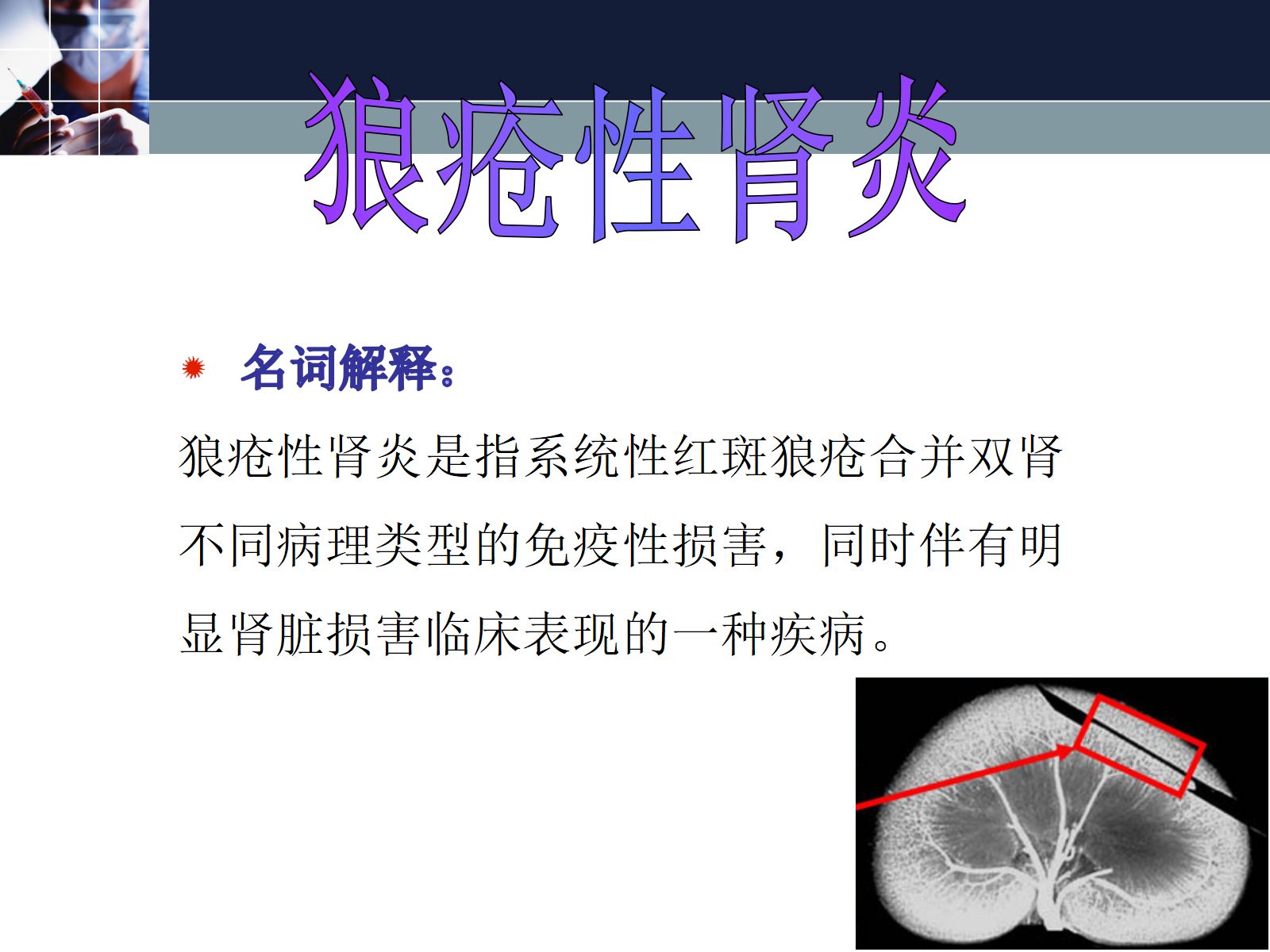狼疮性肾炎的护理常规ppt 第3页