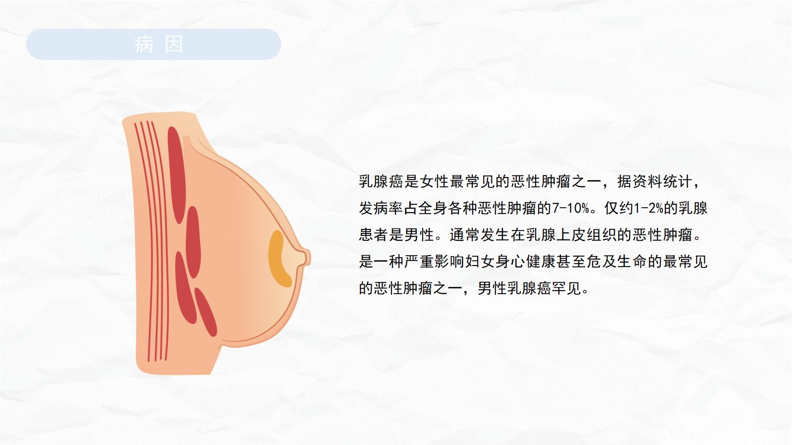乳腺癌护理查房 第4页
