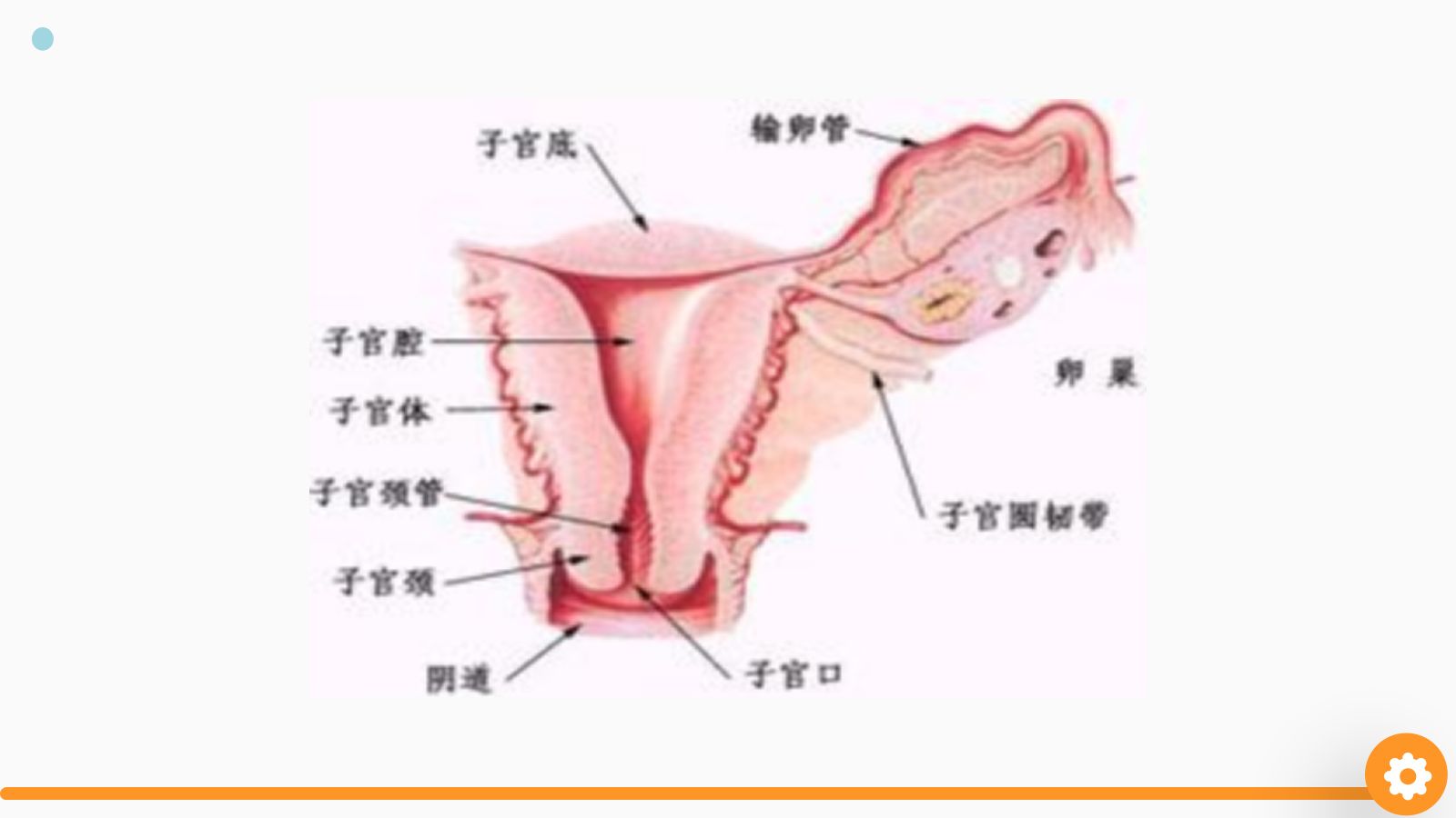 卵巢癌护理查房 第3页