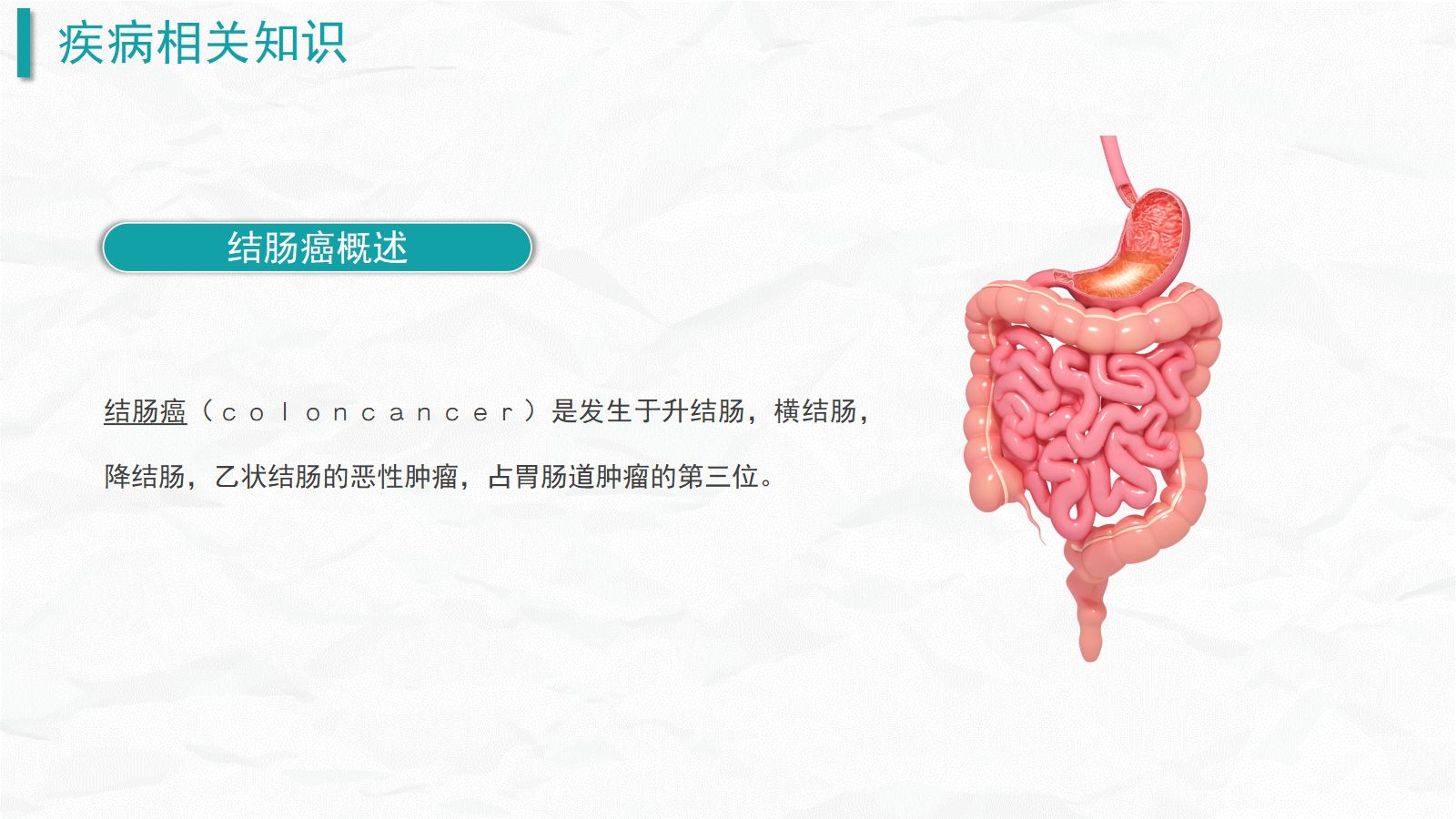 结肠癌护理查房 第4页