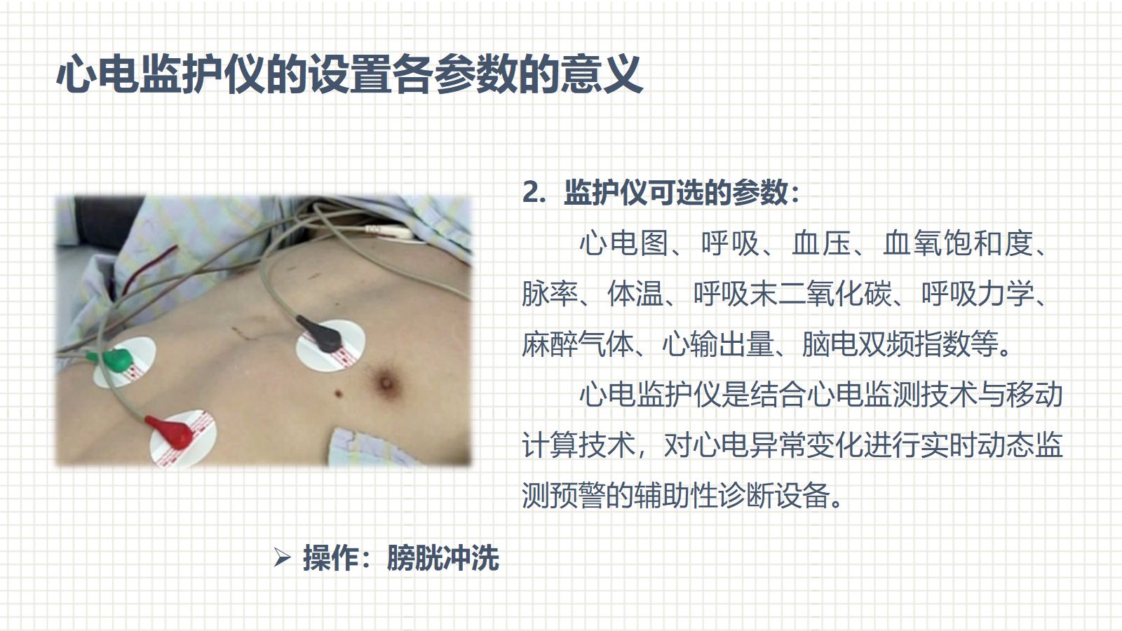 肿瘤科护理小讲课：第六周 第3页