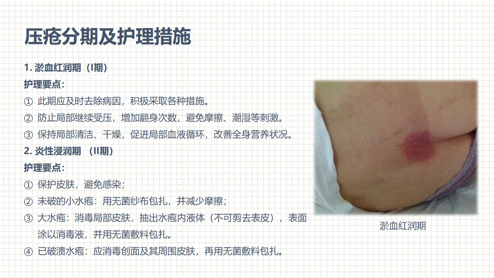 肿瘤科护理小讲课：第四周 第2页
