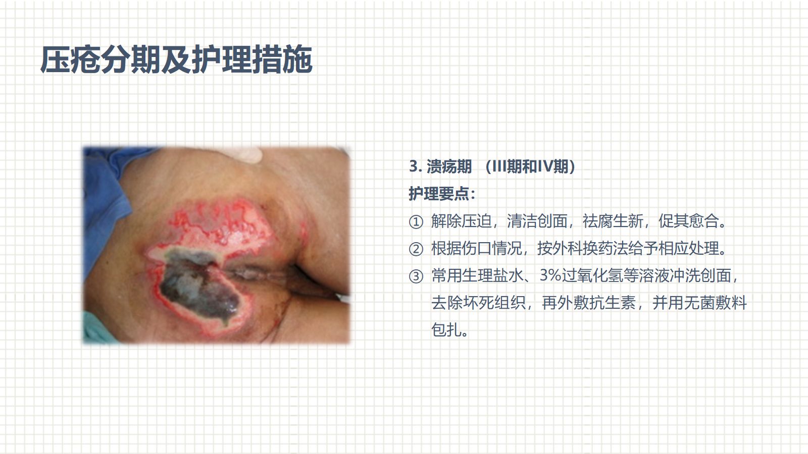 肿瘤科护理小讲课：第四周 第3页