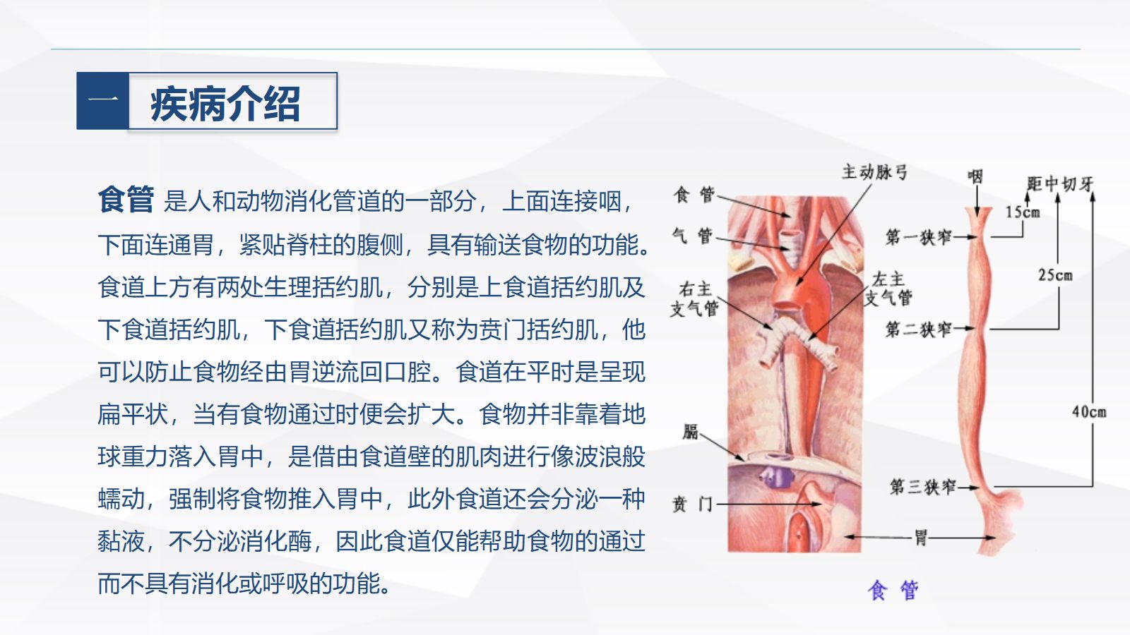 食管癌的护理 第3页