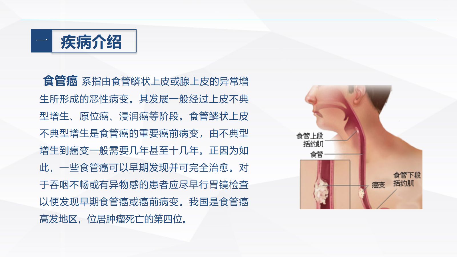食管癌的护理 第4页