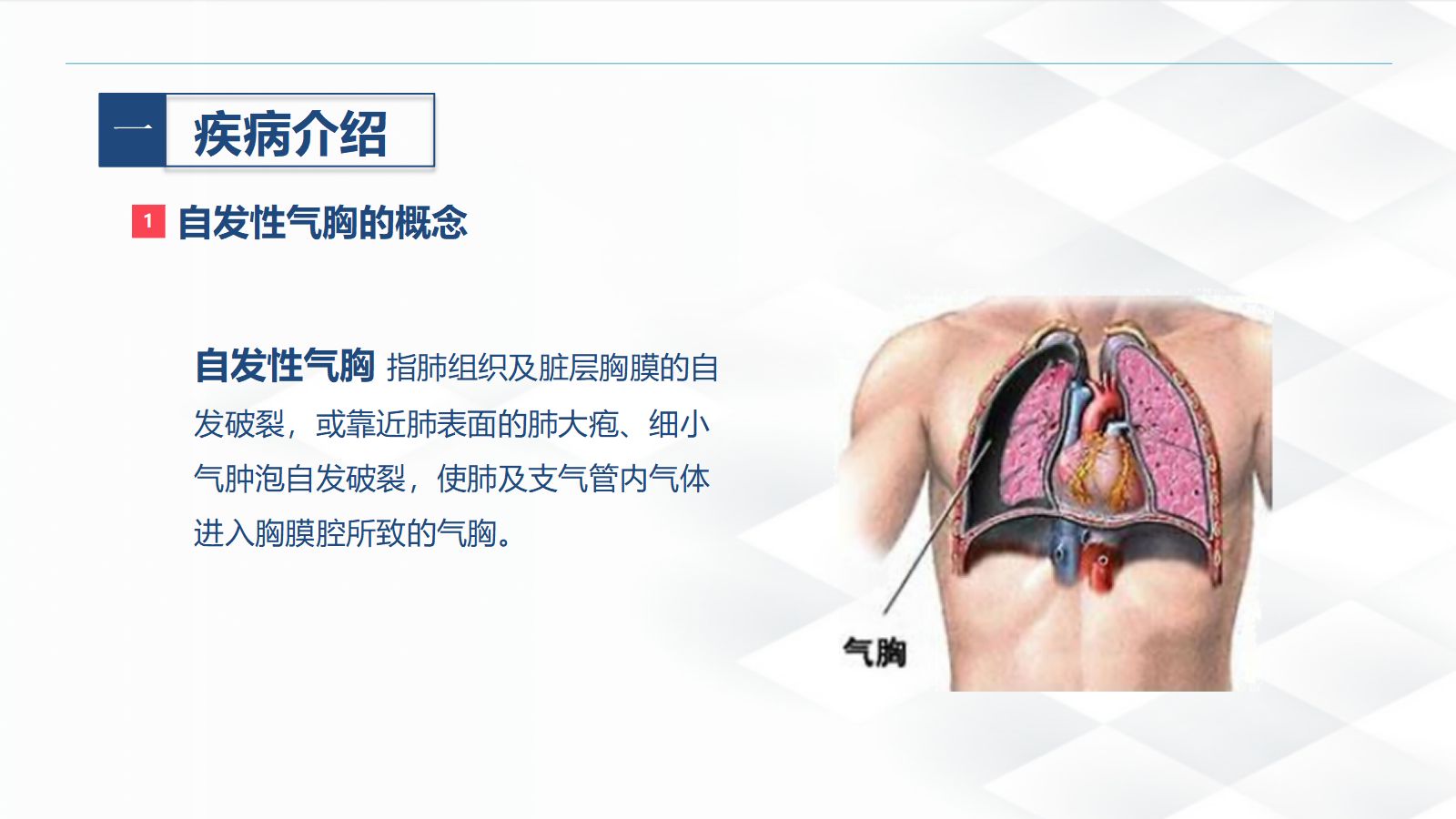 27结核病科-结核性胸膜炎患者自发性气胸的护理查房 第4页