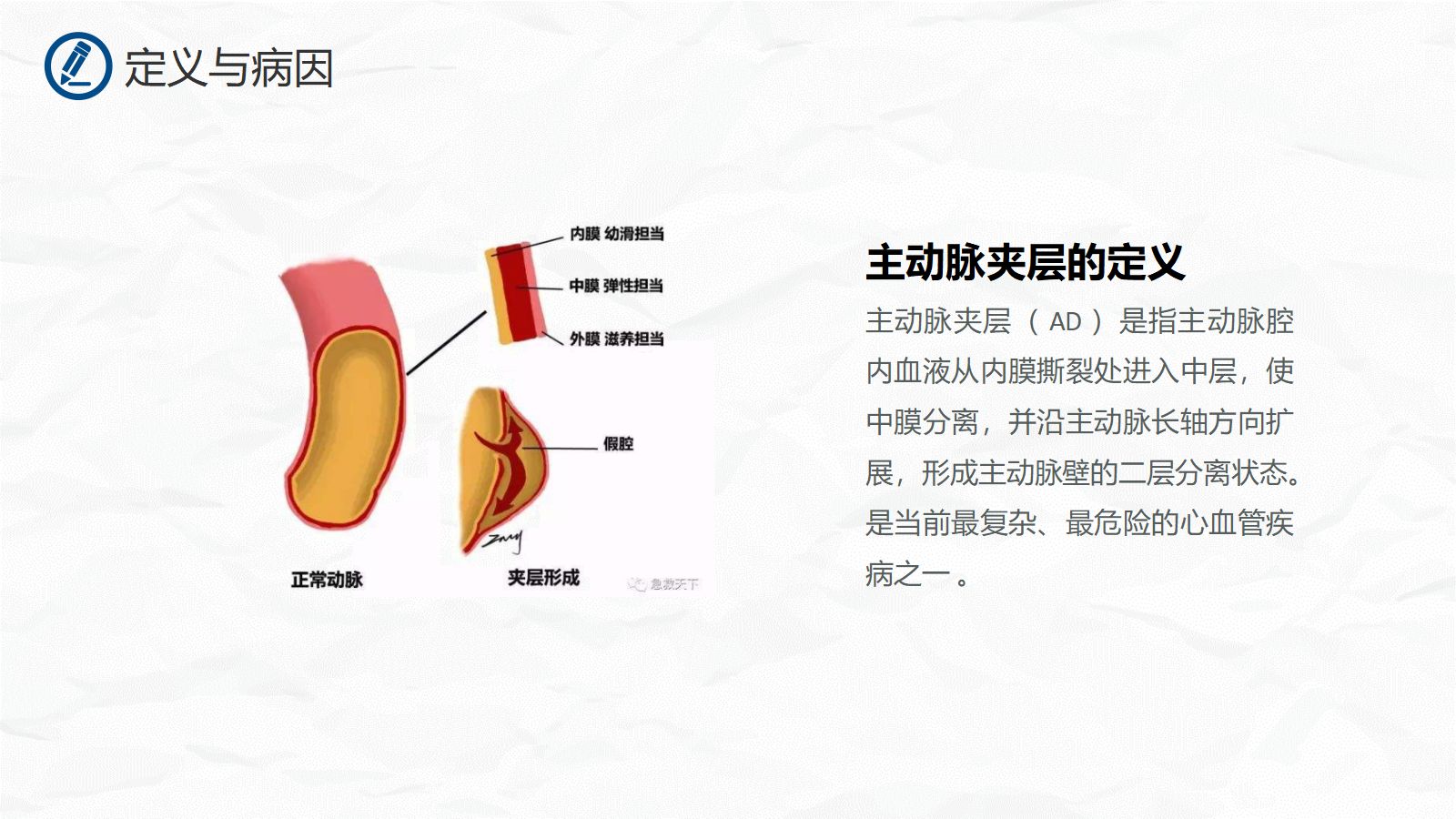 主动脉夹层护理 第4页