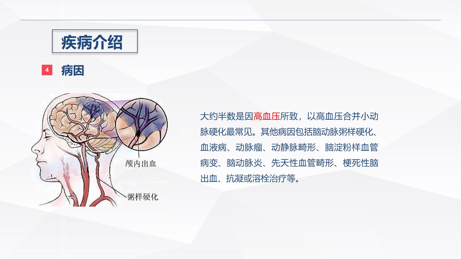 脑出血疾病介绍+术后护理 第5页