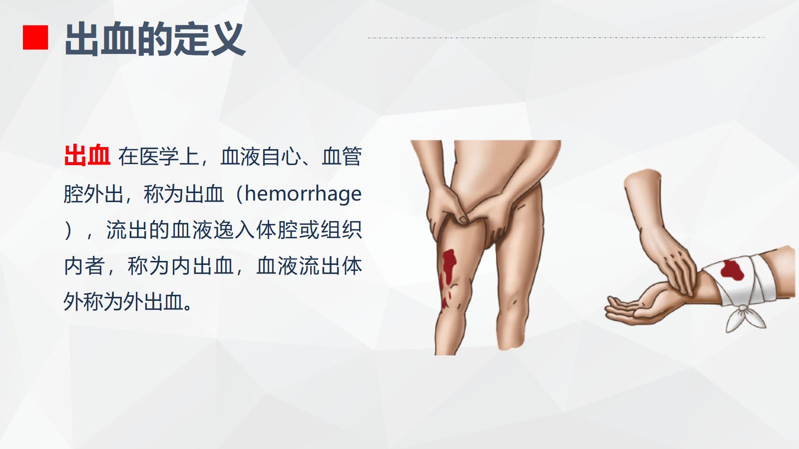 出血的观察和护理 第4页